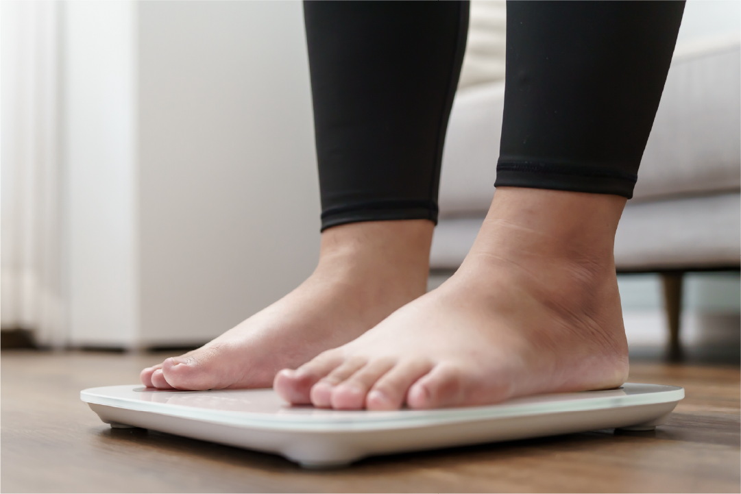 Weight loss options
