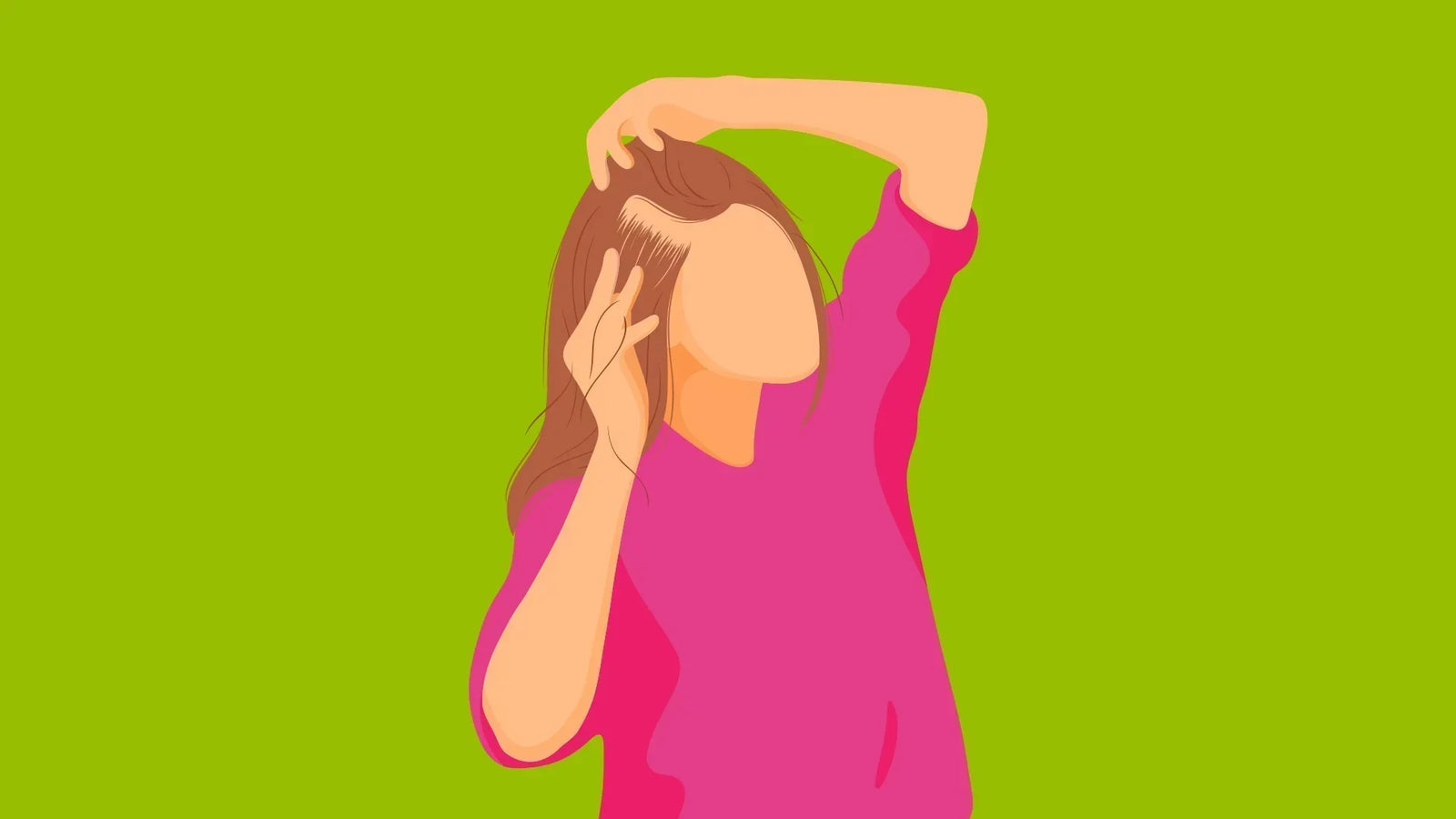 What is telogen effluvium?