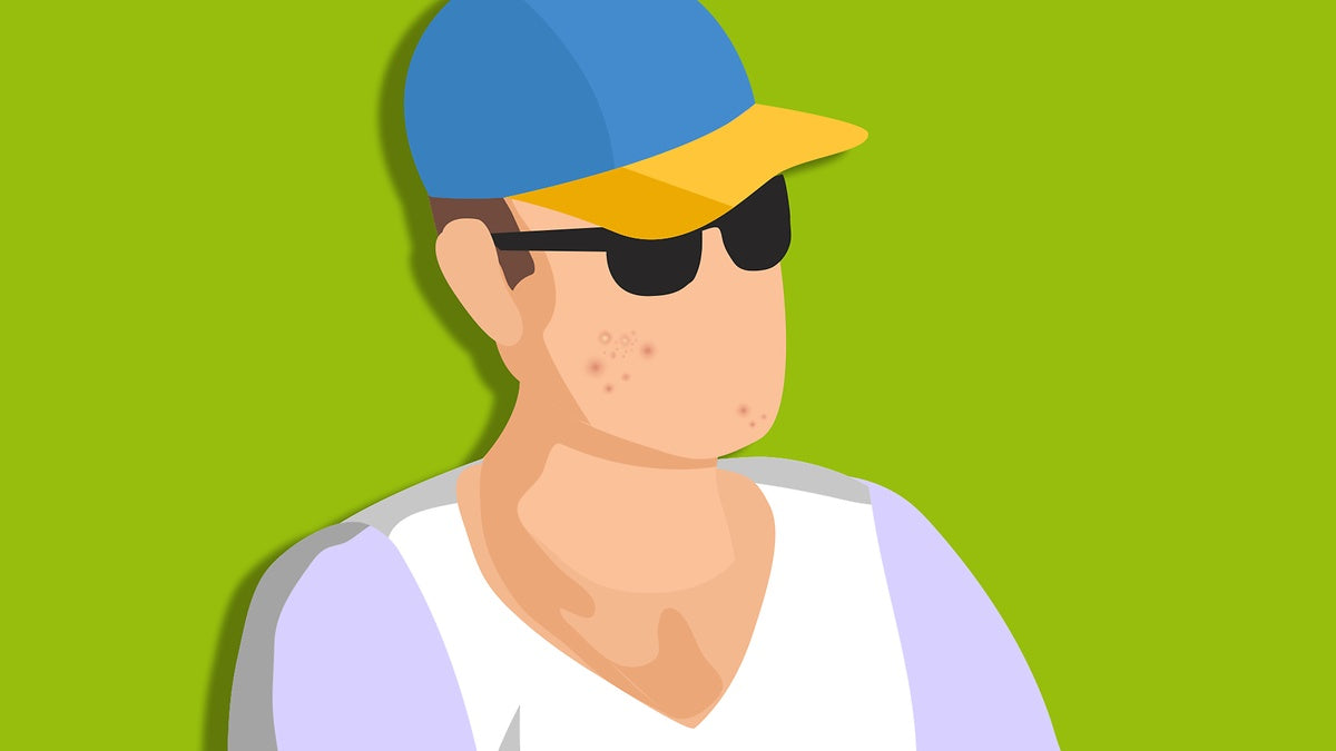 Are some skin conditions better in summer?