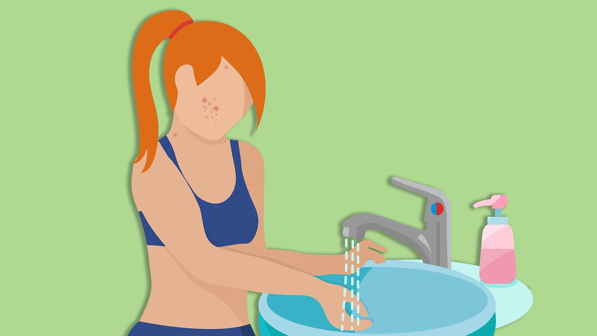 Does diet affect acne?