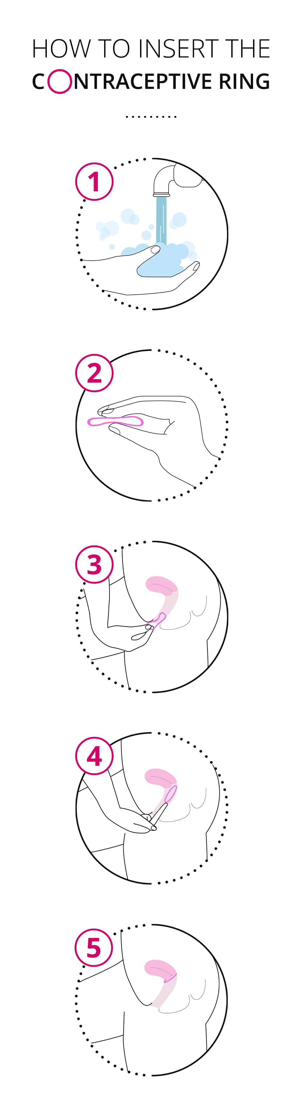 How to insert the contraceptive ring