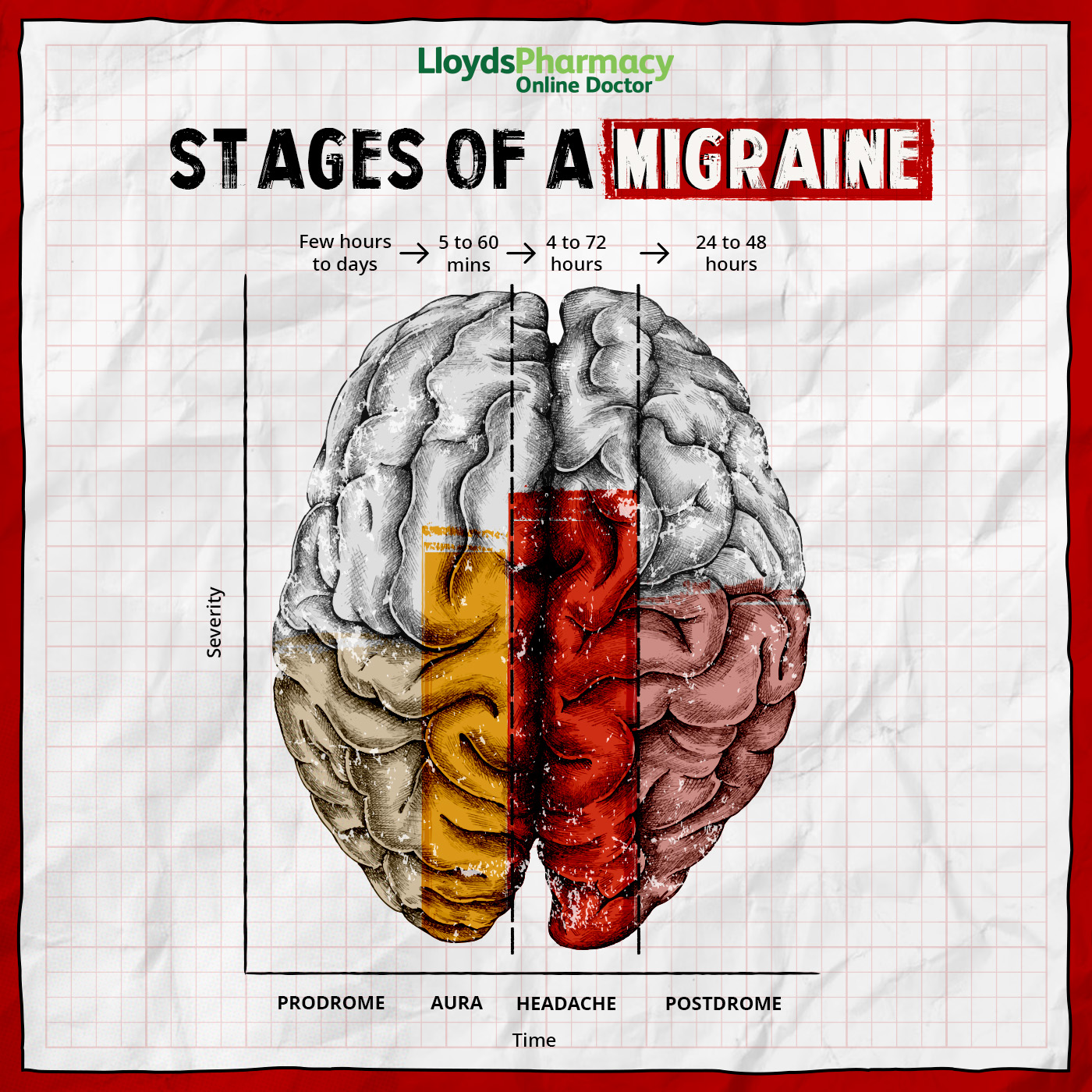Stages of Migraine