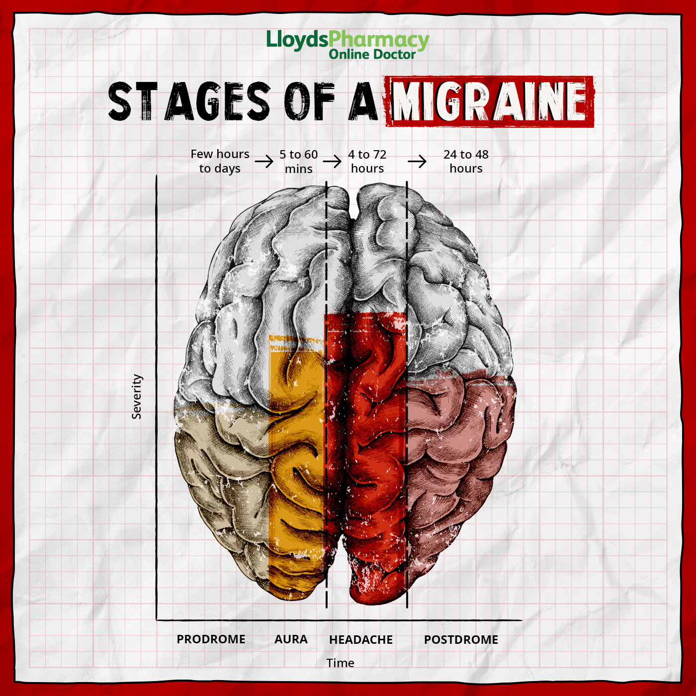 Stages Of Migraines LloydsPharmacy Online Doctor UK