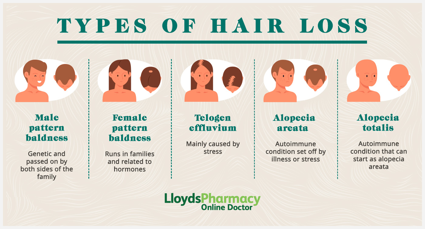 10 Causes of Hair Loss LloydsPharmacy Online Doctor UK