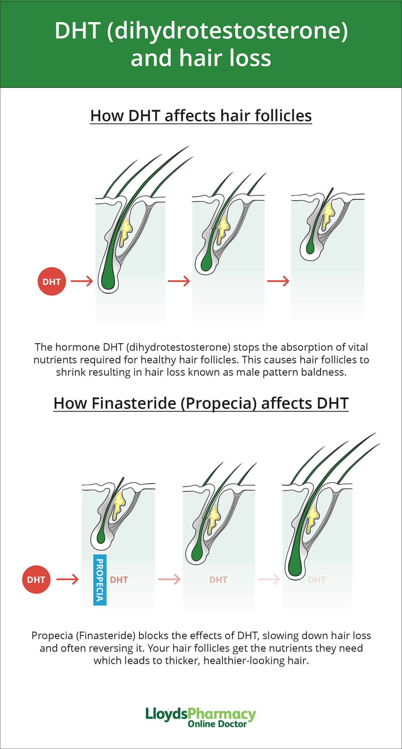 DHT and hair loss - Does propecia work