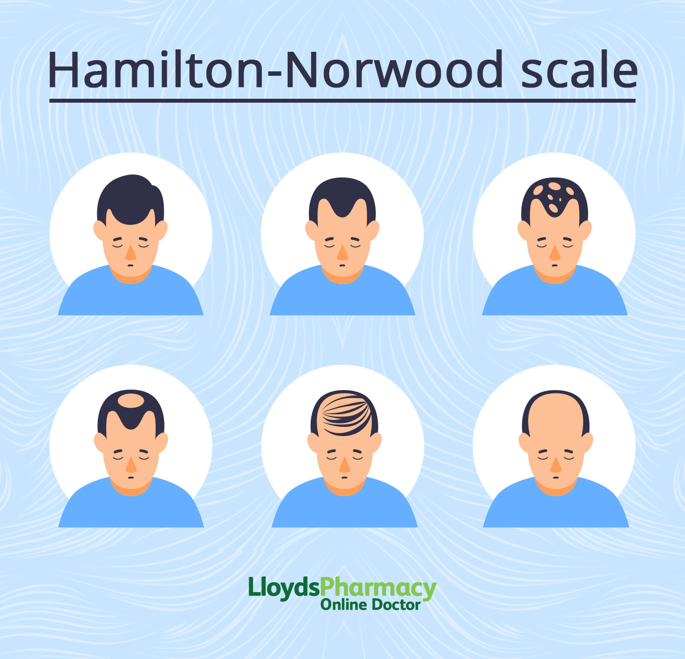 Hamilton Norwood Scale