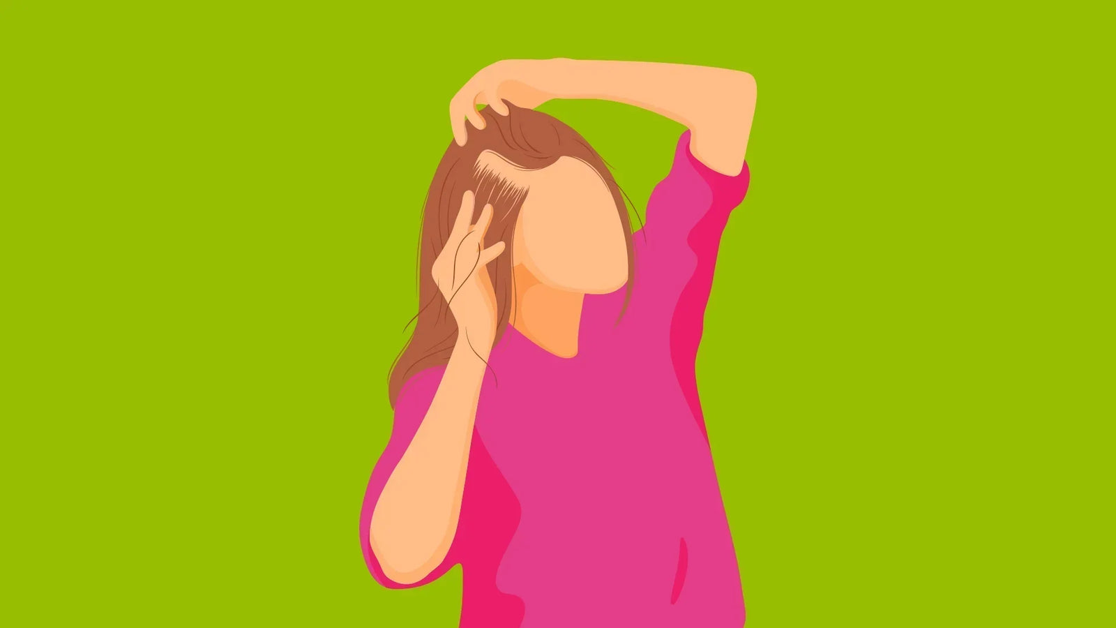 What is telogen effluvium?
