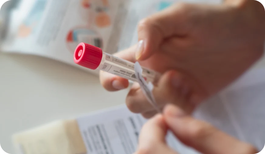 Home blood tests