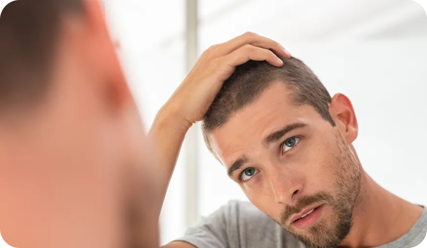 Hair loss for men