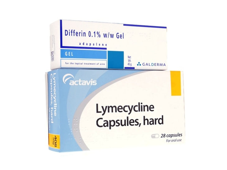 Lymecycline and Adapalene gel for acne