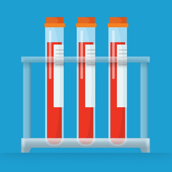 Reasons to get a General Health Blood Test